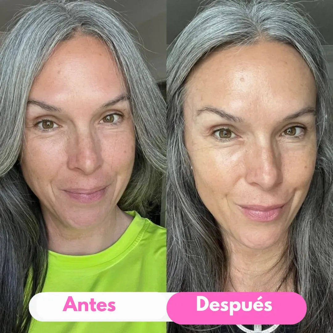 RECUPERA TU BUENA CARA CADA DÍA - Vitalis