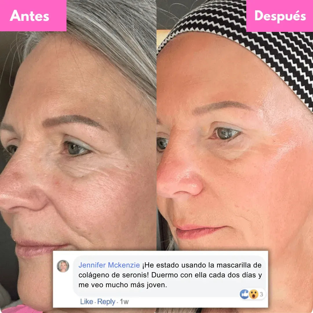 RECUPERA TU BUENA CARA CADA DÍA - Vitalis